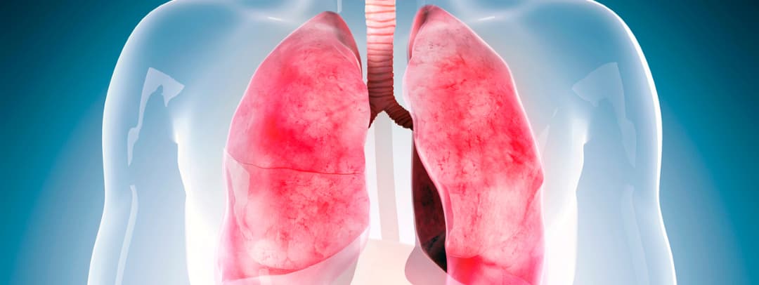 Imagen de los pulmones de una persona